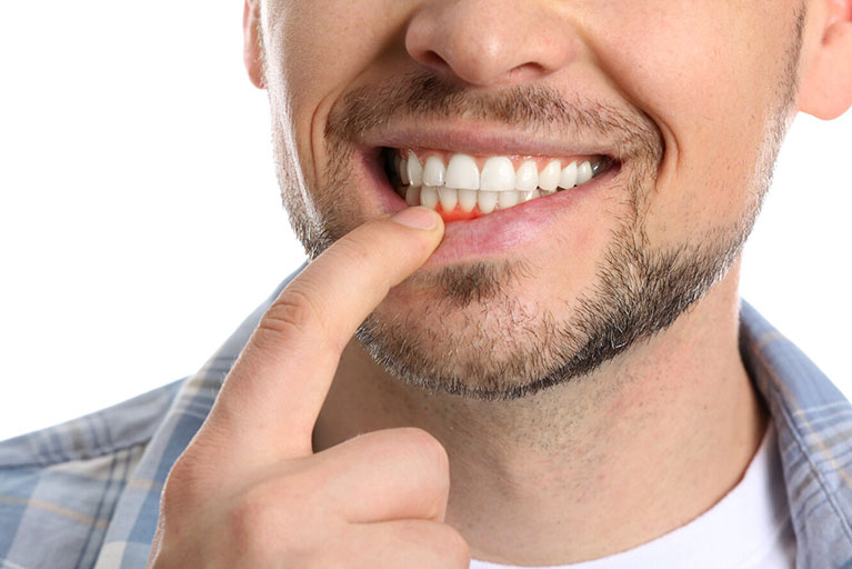 Tres consejos clave para mantener sanas las encías y prevenir la gingivitis